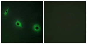 Immunofluorescence of HepG2 cells, using CELSR3 Antibody. The picture on the right is treated with the synthesized peptide.
