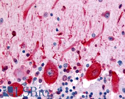 Anti-CELSR3 antibody LS-A1947 IHC of human brain, Purkinje neurons. Immunohistochemistry of formalin-fixed, paraffin-embedded tissue after heat-induced antigen retrieval.