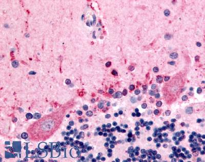 Anti-CELSR3 antibody LS-A2735 IHC of human brain, Purkinje neurons. Immunohistochemistry of formalin-fixed, paraffin-embedded tissue after heat-induced antigen retrieval.