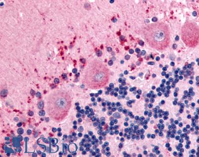 Anti-CELSR3 antibody LS-A2734 IHC of human brain, Purkinje neurons. Immunohistochemistry of formalin-fixed, paraffin-embedded tissue after heat-induced antigen retrieval.