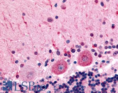 Anti-CELSR3 antibody LS-A2744 IHC of human brain, Purkinje neurons. Immunohistochemistry of formalin-fixed, paraffin-embedded tissue after heat-induced antigen retrieval.