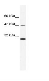 Daudi Cell Lysate