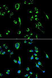 Immunofluorescence analysis of MCF7 cell using APOBEC3G antibody. Blue: DAPI for nuclear staining.