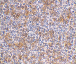 IHC of human spleen using APOBEC3G antibody at 1 ug/ml.