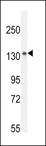 K1199 Antibody western blot of mouse spleen tissue lysates (35 ug/lane). The K1199 antibody detected the K1199 protein (arrow).