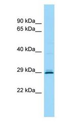 CEMP1 antibody Western Blot of HeLa.