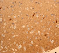 IHC of paraffin-embedded human brain tissue using anti-BM88 antibody (LS-C105716).