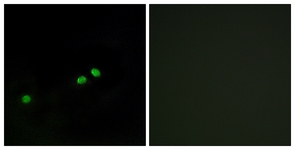 Immunofluorescence of HeLa cells, using Centromeric Protein A (Phospho-Ser7) Antibody. The sample on the right was incubated with synthetic peptide.