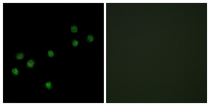 Immunofluorescence of HepG2 cells, using Centromeric Protein A (Ab-7) Antibody. The picture on the right is treated with the synthesized peptide.