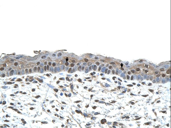 CENPA antibody LS-C80798 was used in IHC to stain formalin-fixed, paraffin-embedded human skin.