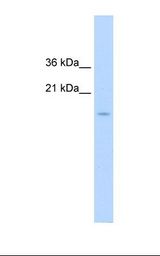 Jurkat cell lysate. Antibody concentration: 1.25 ug/ml. Gel concentration: 15%.