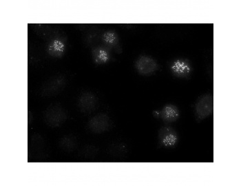 Ovarian cancer cells were arrested with Nocodazole before fixation; primary Ab: anti-CenpE mAb (clone 1H12); Secondary Ab: anti-mouse Alexa 488; chromosome visualization: DAPI