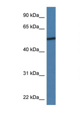ADIPOR2 antibody LS-C135892 Western blot of 435S Cell lysate. Antibody concentration 1 ug/ml.