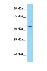 ADIPOR2 antibody LS-C146293 Western blot of 3 Cell lysate. Antibody concentration 1 ug/ml.
