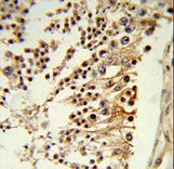 Formalin-fixed and paraffin-embedded human testis tissue reacted with CENPH Antibody , which was peroxidase-conjugated to the secondary antibody, followed by DAB staining. This data demonstrates the use of this antibody for immunohistochemistry; clinical relevance has not been evaluated.