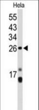 Western blot of CENPH Antibody in HeLa cell line lysates (35 ug/lane). CENPH (arrow) was detected using the purified antibody.