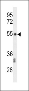 Western blot of CENPI Antibody in CEM cell line lysates (35 ug/lane). CENPI (arrow) was detected using the purified antibody.