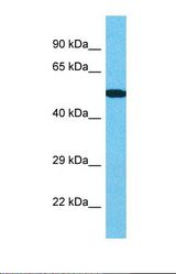 Western blot of Human Thyroid Tumor. CENPI antibody dilution 1.0 ug/ml.
