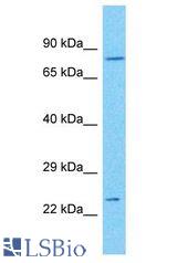 CENPK antibody Western Blot of 293T. Antibody dilution: 1 ug/ml.