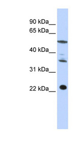CENPM antibody LS-C102218 Western blot of HepG2 cell lysate.