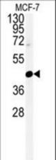Western blot of CENPN Antibody in MCF-7 cell line lysates (35 ug/lane). CENPN (arrow) was detected using the purified antibody.