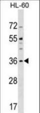 CENPO Antibody western blot of HL-60 cell line lysates (35 ug/lane). The CENPO antibody detected the CENPO protein (arrow).
