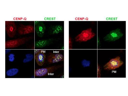 Anti-CENP-Q Antibody - Immunofluorescence Microscopy. Immunofluorescence microscopy using protein A purified anti-CENP-Q antibody shows detection of endogenous CENP-Q in HeLa whole cell lysate. Primary antibody was used at 1:100 followed by secondary antibody diluted 1:150. Red punctate anti-CENP-Q signal colocalizes in overlay images with green punctate anti-CREST signals at the kinetochores (attached points of sister chromatids). Visible are colocalized CENP-Q and CREST signal at various stages of the cell cycle as indicated from interphase to the end of mitosis. Nuclei are counter stained with bisbenzimide. Personal Communication, Kyung S. Lee, CCR-NCI, Bethesda, MD.