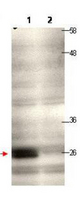 Anti-CENP-Q Antibody - Western Blot. Western blot of protein A purified anti-CENP-Q antibody shows detection of endogenous CENP-Q in a HeLa whole cell lysate (lane 1, arrowhead). The blot was incubated for 1.5 hours at room temperature using the primary antibody diluted to 0.5ug/mL, followed by washes and incubation with to the secondary antibody. Lane 1: Lysates from HeLa cells transfected with control sh-virus. Lane 2: Lysates from HeLa cells transfected with Cenp-Q sh-virus. Personal Communication, Kyung S. Lee, CCR-NCI, Bethesda, MD.