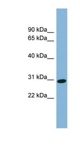CENPQ antibody LS-C111976 Western blot of Fetal liver lysate.