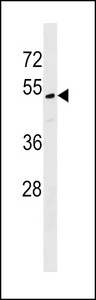 MLF1IP Antibody western blot of WiDr cell line lysates (35 ug/lane). The MLF1IP antibody detected the MLF1IP protein (arrow).