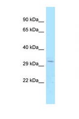 CENPV antibody LS-C146014 Western blot of Fetal Lung lysate. Antibody concentration 1 ug/ml.