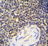 ACAP1 Antibody immunohistochemistry of formalin-fixed and paraffin-embedded human spleen tissue followed by peroxidase-conjugated secondary antibody and DAB staining.