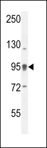 ACAP1 Antibody western blot of ZR-75-1 cell line lysates (35 ug/lane). The ACAP1 antibody detected the ACAP1 protein (arrow).