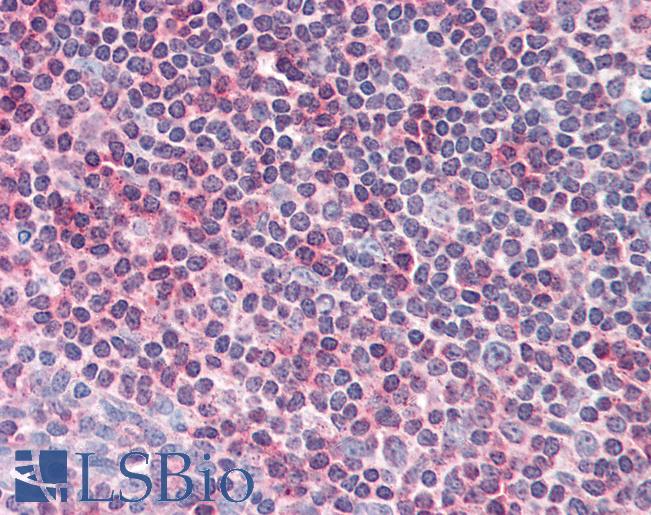 Anti-ACAP1 / CENTB1 antibody IHC of human tonsil. Immunohistochemistry of formalin-fixed, paraffin-embedded tissue after heat-induced antigen retrieval. Antibody LS-B2280 concentration 5 ug/ml.