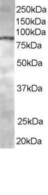 Antibody2 staining (0.5 ug/ml) of Jurkat lysate (RIPA buffer, 35 ug total protein per lane). Primary incubated for 1 hour. Detected by Western blot of chemiluminescence.