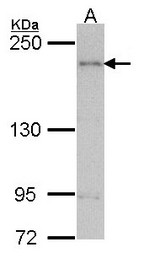 Sample (30 ug of whole cell lysate). A: H1299. 5% SDS PAGE. CENTD2 / ARAP1 antibody diluted at 1:1000.