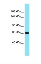Western blot of Human 721_B. CEP104 antibody dilution 1.0 ug/ml.