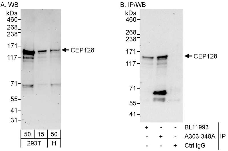 Detection of Human CEP128 by Western Blot and Immunoprecipitation. Samples: Whole cell lysate from 293T (15 and 50 ug for WB; 1 mg for IP, 20% of IP loaded) and HeLa (H; 50 ug) cells. Antibodies: Affinity purified rabbit anti-CEP128 antibody used for WB at 1 ug/ml (A and B) and used for IP at 6 ug/mg lysate. CEP128 was also immunoprecipitated by rabbit anti-CEP128 antibody BL11993, which recognizes an upstream epitope. Detection: Chemiluminescence with exposure times of 3 minutes (A) and 30 seconds (B).