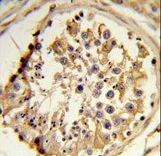 Formalin-fixed and paraffin-embedded human testis reacted with C14orf145 Antibody , which was peroxidase-conjugated to the secondary antibody, followed by DAB staining. This data demonstrates the use of this antibody for immunohistochemistry; clinical relevance has not been evaluated.