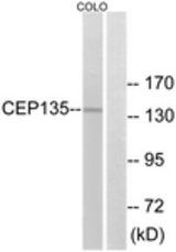 Western blot of extracts from COLO cells, using CEP135 Antibody. The lane on the right is treated with the synthesized peptide.