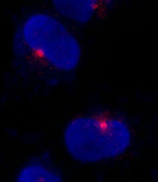 Detection of Human CEP290 by Immunocytochemistry. Sample: NBF-fixed asynchronous HeLa cells. Antibody: Affinity purified rabbit anti-CEP290 used at a dilution of 1:500. Detection: Red-fluorescent goat anti-rabbit IgG cross-adsorbed Antibody DyLight 594 (A120-601D4) used at a dilution of 1:100.