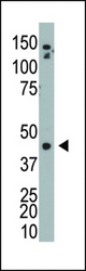The anti-ADK antibody is used in Western blot to detect ADK in mouse bladder tissue lysate.