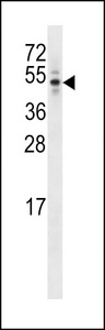 K1712 Antibody western blot of T47D cell line lysates (35 ug/lane). The K1712 Antibody detected the K1712 protein (arrow).