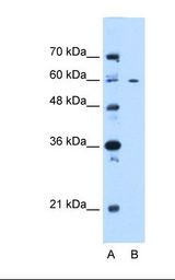 Lane A: Marker. Lane B: 721B cell lysate. Antibody concentration: 0.25 ug/ml. Gel concentration: 12%.