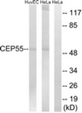 Western blot of extracts from HeLa/HUVEC cells, using CEP55 Antibody. The lane on the right is treated with the synthesized peptide.