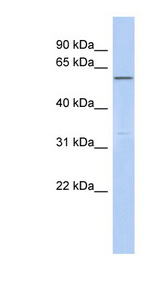 CEP57L1 / C6orf182 antibody LS-C111691 Western blot of Fetal liver lysate.