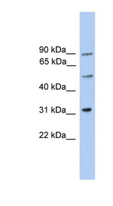 CEP57L1 / C6orf182 antibody LS-C135349 Western blot of Jurkat lysate.