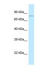 CEP68 antibody LS-C145847 Western blot of Fetal Liver lysate. Antibody concentration 1 ug/ml.