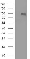 HEK293T cells were transfected with the pCMV6-ENTRY control (Left lane) or pCMV6-ENTRY CEP68 (Right lane) cDNA for 48 hrs and lysed. Equivalent amounts of cell lysates (5 ug per lane) were separated by SDS-PAGE and immunoblotted with anti-CEP68.