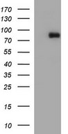 HEK293T cells were transfected with the pCMV6-ENTRY control (Left lane) or pCMV6-ENTRY CEP68 (Right lane) cDNA for 48 hrs and lysed. Equivalent amounts of cell lysates (5 ug per lane) were separated by SDS-PAGE and immunoblotted with anti-CEP68.